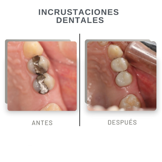 resultados4