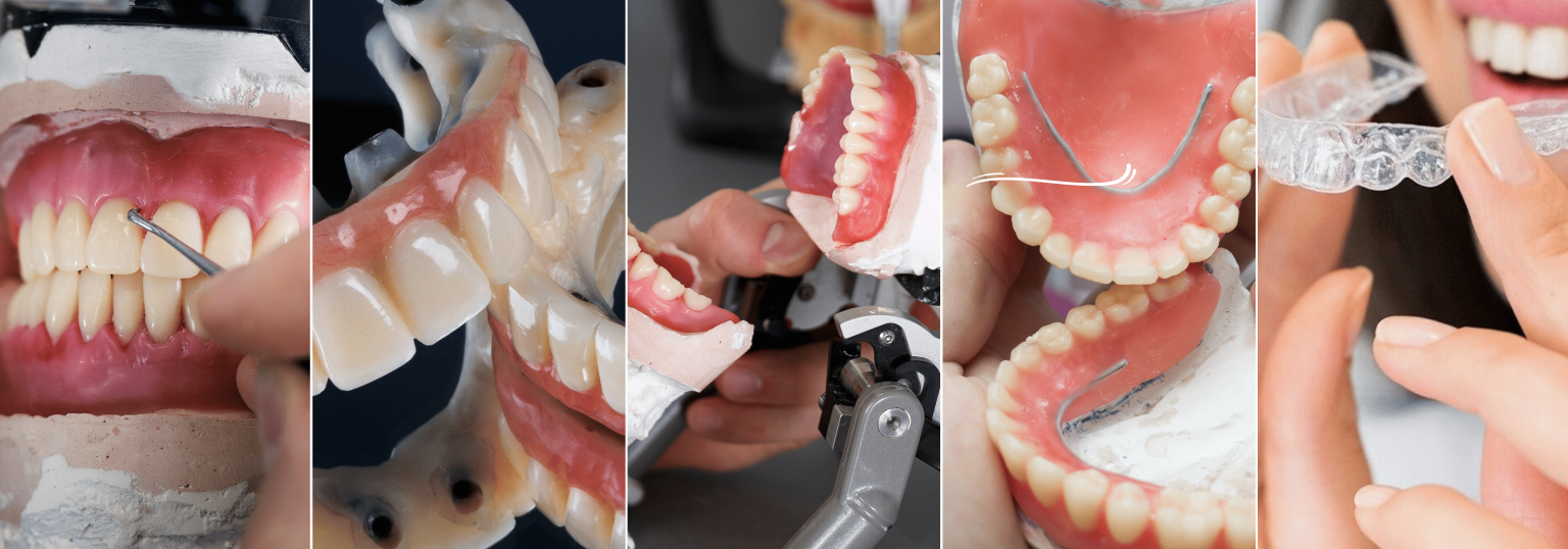 prótesis dentales (1)